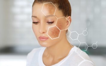 Manchas en la cara: causas de su aparición, tipos y cómo prevenirlas