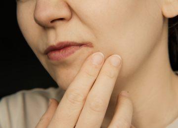 ¿Cómo quitar calentura labial rápidamente?
