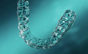 Ortodoncia invisible: Esto es lo que debes saber