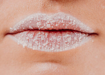 ¿Tienes puntos blancos en los labios? Te explicamos qué son